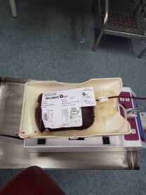 Kesa za darovanu krv, nulta krvna grupa