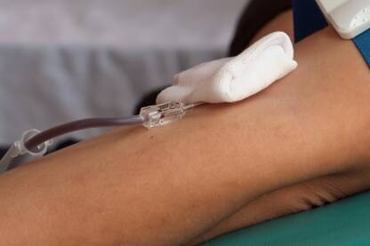 Dobrovoljni davaoc krvi daruje krv. Krupni plan ruke u procesu darivanja krvi.