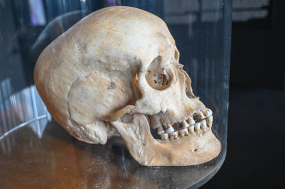 Lobanja odraslog čovjeka, izložena u Muzeju vučedolske kulture u Vukovaru.