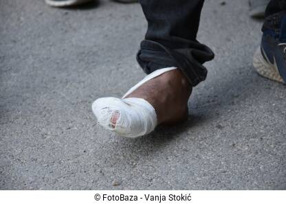 Zamotano stopalo. Muškarac sa povrijeđenom nogom. Migrant/izbjeglica sa povrijeđenom nogom.