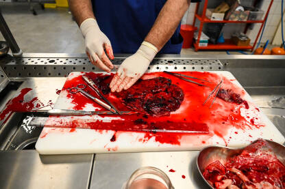 Mrtvozornik obavlja biopsiju unutarnjih organa. Doktor koji koristi skalpel. Krvavi ljudski organi.